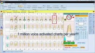 The DenChart Advantage - Perio Voice Charting