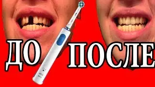 Электрическая Зубная Щетка. За и Против (Обзор Oral-B Pro 600) [ПЕРЕЗАЛИВ С ПРОШЛОГО КАНАЛА]