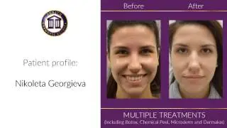 Nikoleta Georgieva - patient experience at Zenith Cosmetic Clinics