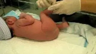 X. Bruce Lee, ( 李献博 li xian bo ) newly born， 出生之后几分钟