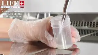 🧪 Semen Analysis in Andrology Lab &ndash; Understanding Male Fertility! 💙