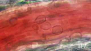 Leukocyte transmigration -白血球の血管外への移動（遊出）-