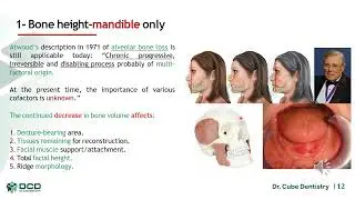 Short Pros5 Lec.1 P.1 Classification System For Completely Edentulous