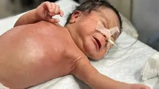 Newborn Baby Hungry & Feeding with Love and Care 🤍🍼 #feedingtime #newbornbaby 