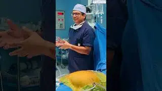 HIPEC Therapy: Advanced Cancer Treatment #hipec #cancer