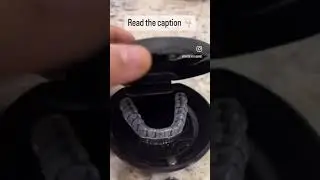 Mouth guard | Treatment for teeth grinding and Bruxism | The Dental Bond, Mumbai