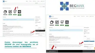 Archivos DICOM