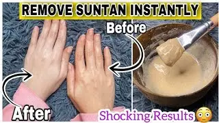  Tan removal home remedies | Tan removal home remedies malayalam | best face pack for tan removal 