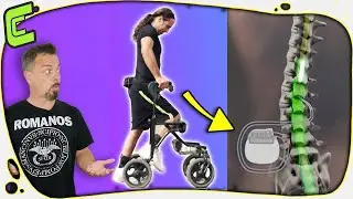 🚶🏽¡WoooW! Volver a caminar después de recibir un implante de electrodos