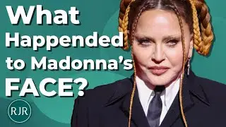 What Happened to Madonna&rsquo;s Face!