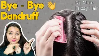 1 Remedy to Remove Dandruff Fast & Control Frizzy Hair | Guaranteed Results!