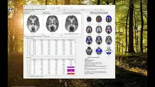 NeuroQ launch review file