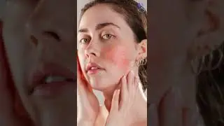 Hard Water: The Hidden Cause of Acne, Dry Skin, and Hair Damage #haircare Dr Gulhima Arora