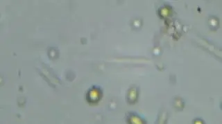 euglena, chlorella & filamentous algae sample moody ramp