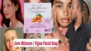 Vigwa Facial Soap Review In Hindi