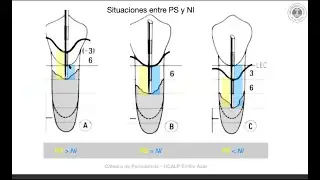 Diagnóstico Clínico Periodoncia I Dr  Emilio Azar 30 4 20