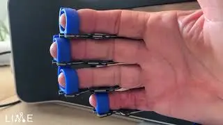 Application of AnyHand in post-operative treatment
