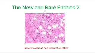 PATH ILLUMINATOR- SOFT TISSUE PATHOLOGY: lipoblastoma like tumor