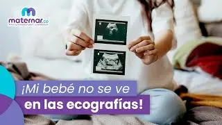 &iquest;Qu&eacute; pasa cuando mi beb&eacute; no se ve en las ecograf&iacute;as? 👶🏼 #Shorts | Maternar.co