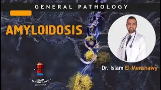 Amyloidosis