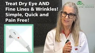 MD Elite IPL Dry Eye Treatment at Deforrest Eye Center
