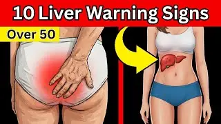 10 Early Warning Signs Your Liver Is in Trouble (Most Seniors Ignore #10)