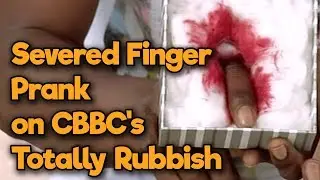 How to make the Severed Finger Prank | Totally Rubbish | CBBC