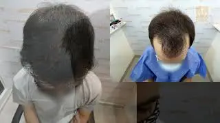 2500 Uf Frontal y entradas