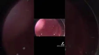 what can we see under the microscope #laboratory #medtechstudent #medtech #microscope