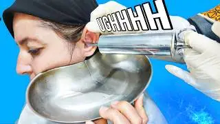 Satisfying Ear Washing with Warm Water 😌👂🏻💧 #earwaxextraction #earwaxremoval #satisfying