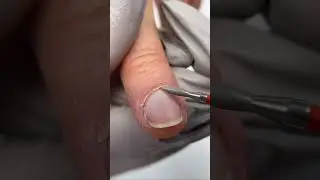 How to remove overgrown cuticles #shorts