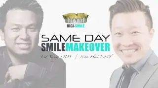Digi-Smile: Same Day Smile (Pre-Op)