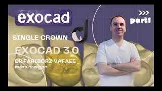 How to design single crown like a pro in exocad 3.0 (part1)
