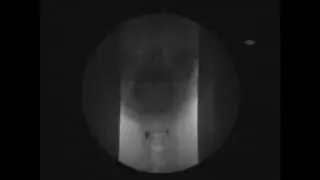 VFS - Videofluoroscopy Assessment of Swallowing - R&ouml;ntgen Schluckakt