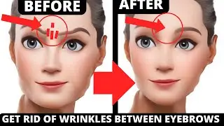 Smooth Frown Lines FAST: 4-Min Face Workout, No Botox Needed!