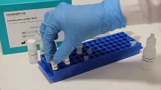 Leukocytes slides SCA Tutorial