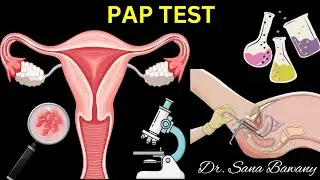 What is PAP Test ? Why Pap Test is Done