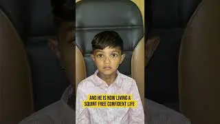 Child Eye Alignment Restored  Real Squint Treatment Journey &ndash; Dr  Ankit Shah Eye Specialist