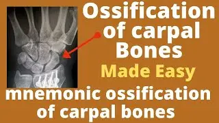 Carpal bones ossification | importance of ossification of carpal bones|Estimation of age from carpal