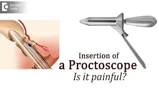 Purpose of proctoscopy. How will a doctor insert a Proctoscope? - Dr. Rajasekhar M R