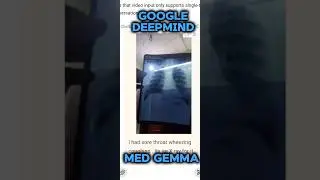 this healthcare Ai by Google deepmind built on 4B parameters & 27 bit for text comprehension #ai
