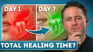 How Long Does It Take To Recover From Dental Implants?
