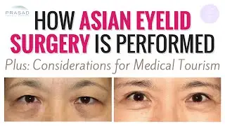 Asian Eyelid Surgery - How Age Often Determines Surgical Technique, and Factors for Medical Travel