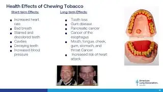 Tobacco-free Policy in Child Care Centers