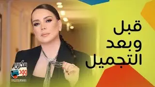 شكران مرتجي والتنمر عليها بعد عمليات التجميل .. تعيش قصة حب وسنها فوق الخمسين