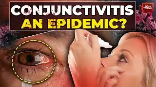 Conjunctivitis Cases On The Rise: How Does Pink Eye Spread?