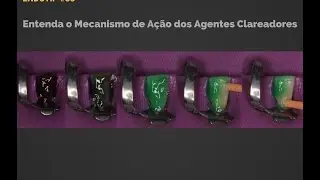 Saiba Como É O Mecanismo De Ação Dos Agentes Clareadores No Clareamento Do Pigmento