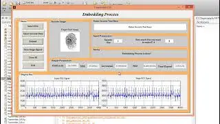 MATLAB code of Curvelet Based ECG Steganography for Privacy Protection