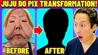 JuJu Do Pix Gets Corrective Plastic Surgery! Extreme Bodies Explained!