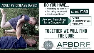 Adult Polyglucosan Body Disease (APBD) a type of Glycogen Storage Disease Type 4 (GSD IV)
